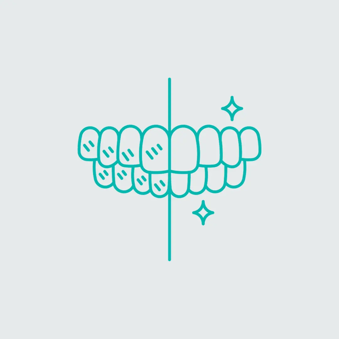 Blanqueamiento dental