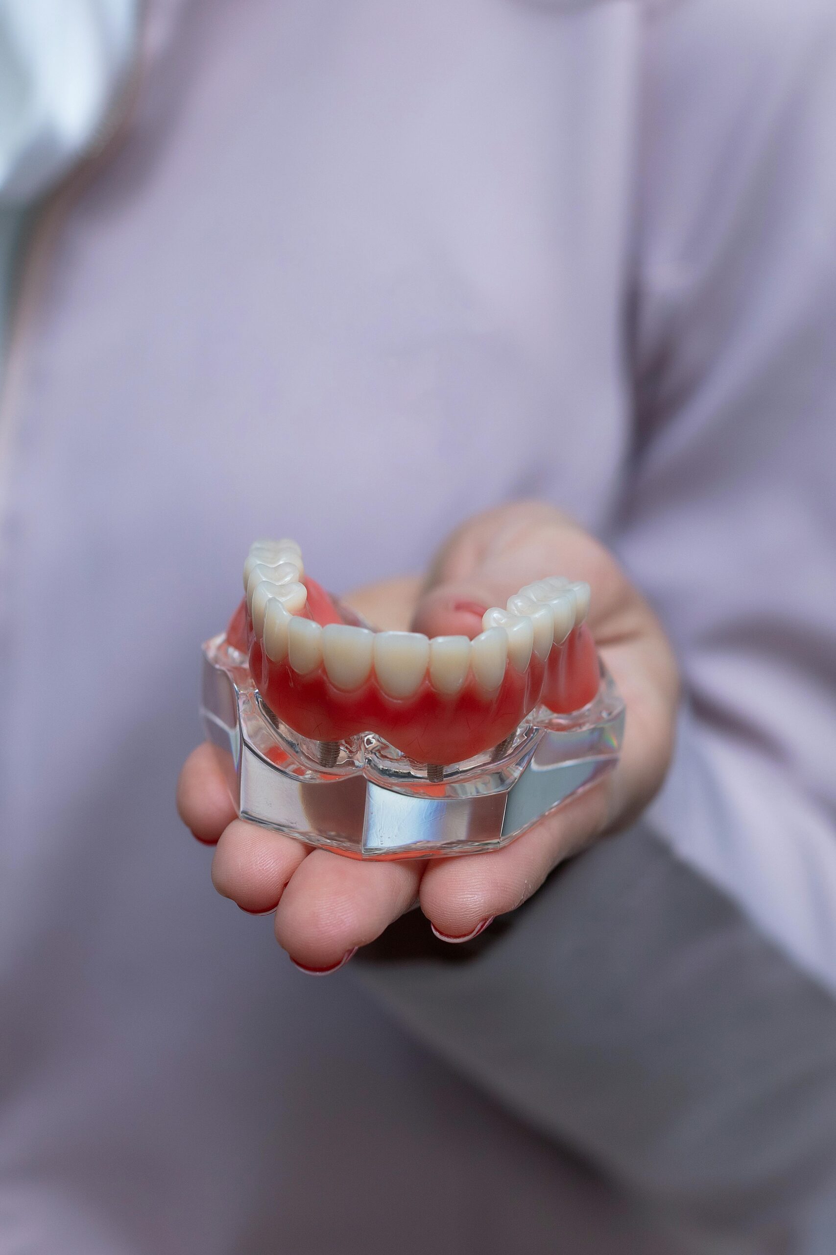 Tratamiento de implantología dental en Santiago