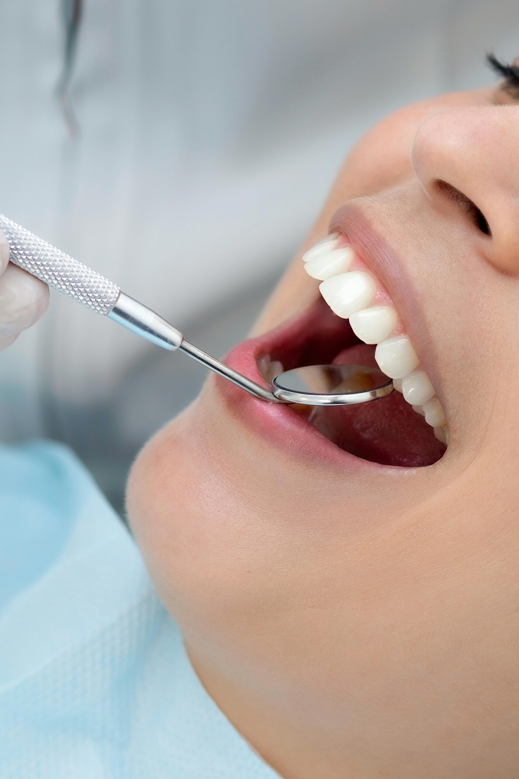 Tratamiento de periodoncia en Santiago de Compostela