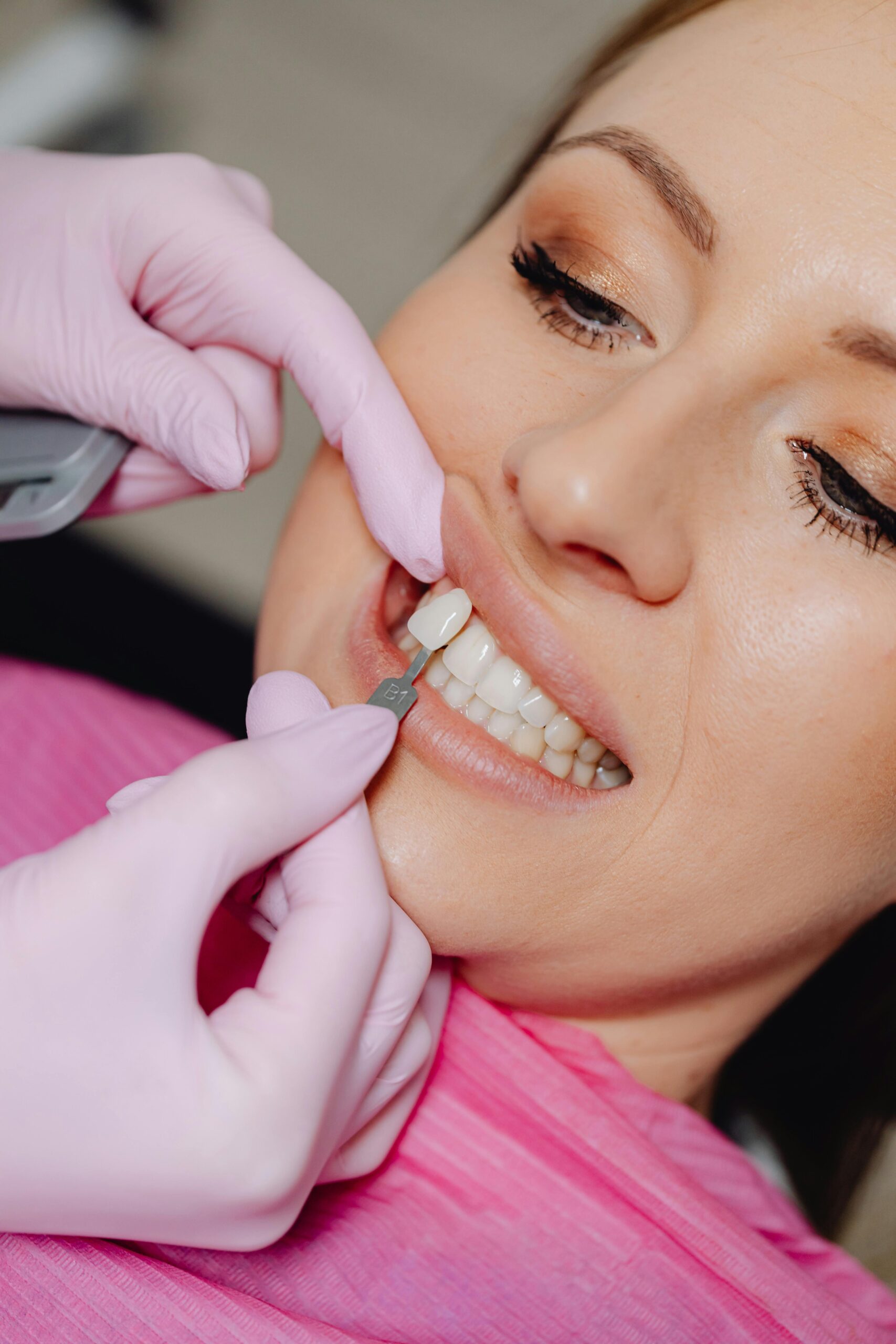 Tratamiento de estética dental y sonrisa