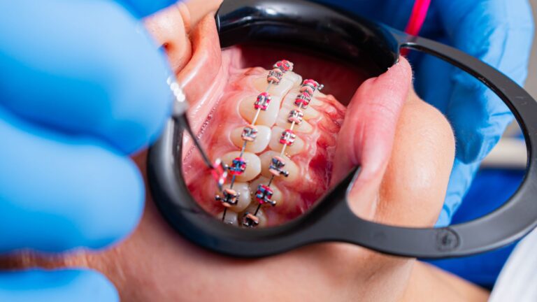 Niña con ortodoncia infantil sonriendo en la consulta del dentista